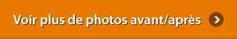 Bouton pour voir plus de résultats avant et après Profolan